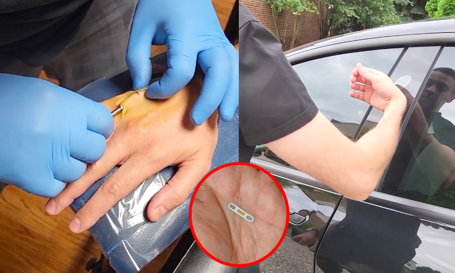 Implanting a microchip in the hand to open the car